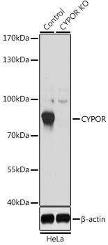 Anti-POR Polyclonal Antibody [KO Validated] (CAB8142)