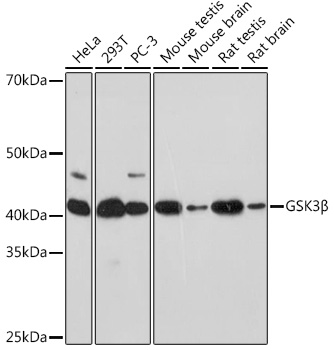 Anti-GSK3Beta Antibody