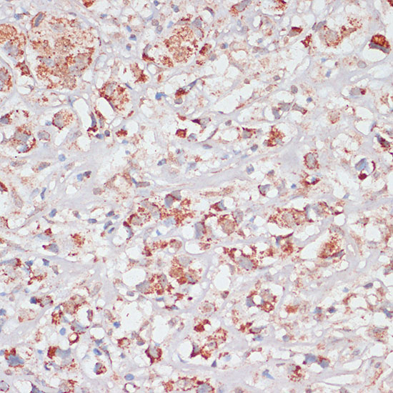 Anti-Desmoplakin Antibody (CAB7635)