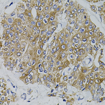 Anti-ARHGEF11 Polyclonal Antibody (CAB7954)