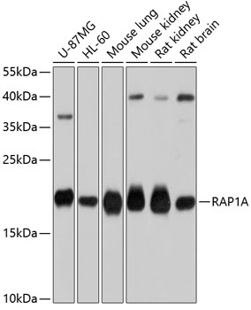 Anti-RAP1A Antibody (CAB0975)