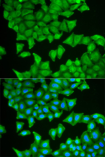 Anti-PTGES3 Antibody (CAB13399)