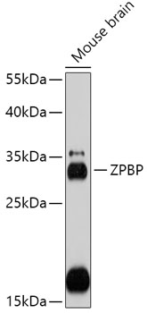 Anti-ZPBP Antibody (CAB17625)