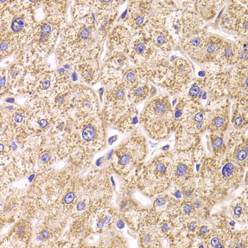 Anti-ST3GAL3 Antibody (CAB6753)