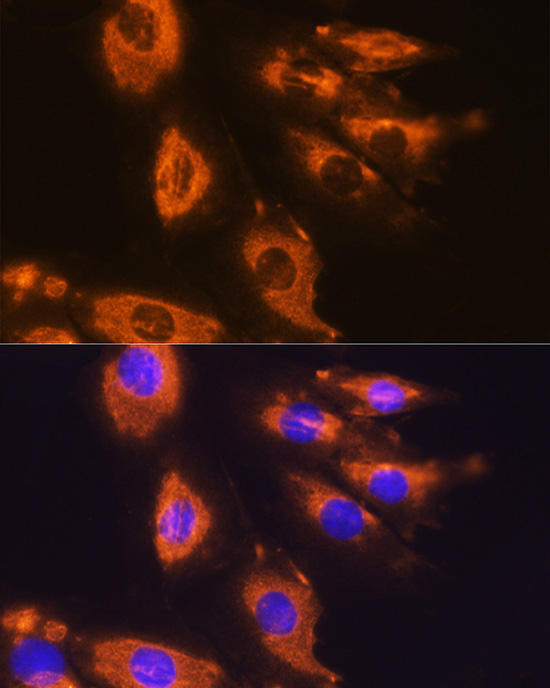 Anti-DAG1 Antibody (CAB10076)