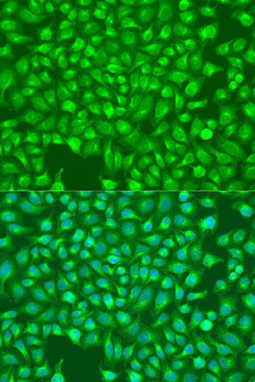 Anti-IP3R Antibody (CAB14008)