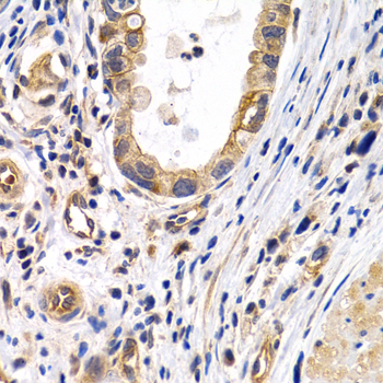 Anti-PTGIR Antibody (CAB1849)