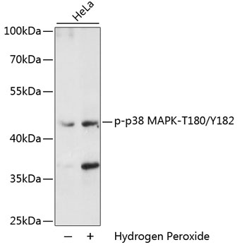 Anti-Phospho-MAPK14-T180/Y182 Antibody (CABP0526)