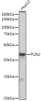 Anti-PLIN2 Antibody (CAB6276)