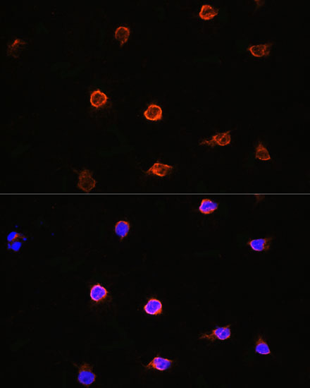 Anti-AIPL1 Antibody (CAB14113)