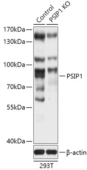 Anti-PSIP1 Antibody [KO Validated] (CAB18037)