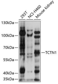 Anti-TCTN1 Antibody (CAB14929)