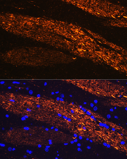 Anti-NEFL Antibody (CAB0257)