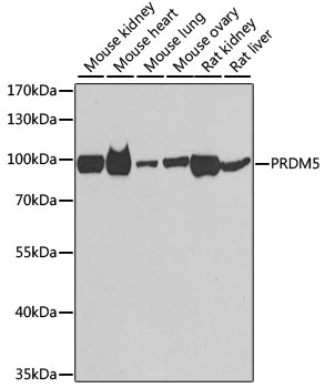 Anti-PRDM5 Antibody (CAB7361)