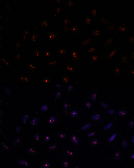 Anti-METTL16 Antibody (CAB15894)