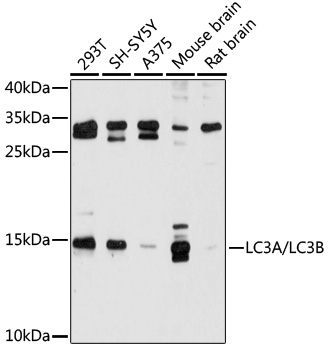 Anti-LC3A/LC3B Antibody (CAB5618)