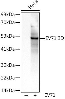 Western blot analysis of extracts of HeLa cells, using EV71 3D antibody at 1:1000 dilution. Secondary antibody: HRP Goat Anti-Rabbit IgG (H+L) at 1:10000 dilution. Lysates/proteins: 25ug per lane. Blocking buffer: 3% nonfat dry milk in TBST. Detection: ECL Basic Kit. Exposure time: 3s.