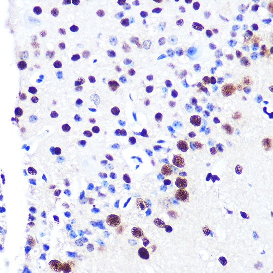 Anti-RbAp48 Antibody [KO Validated] (CAB3645)