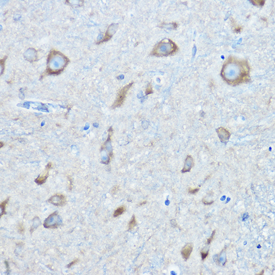 Anti-SARS Antibody (CAB13350)