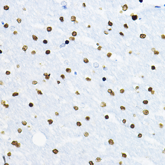 Anti-SOX10 Antibody (CAB15100)