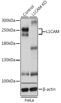 Anti-L1CAM Polyclonal Antibody [KO Validated] (CAB8555)