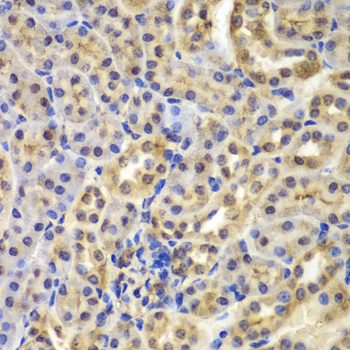 Anti-IkBAlpha Antibody (CAB11165)