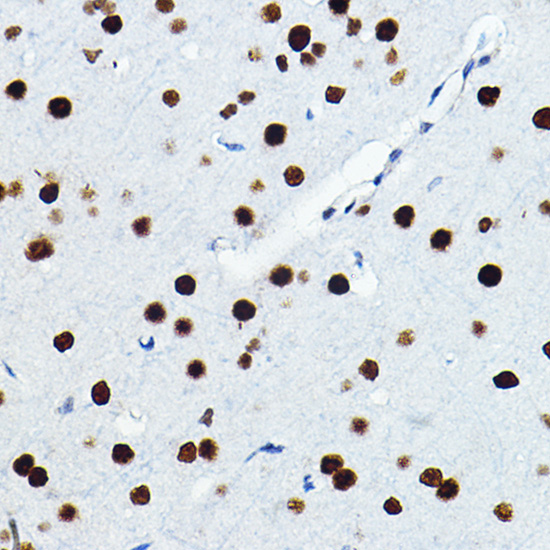 Anti-FOSL1 Antibody (CAB5372)