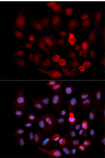 Anti-Phospho-ABL1-Y412 Antibody (CABP0303)