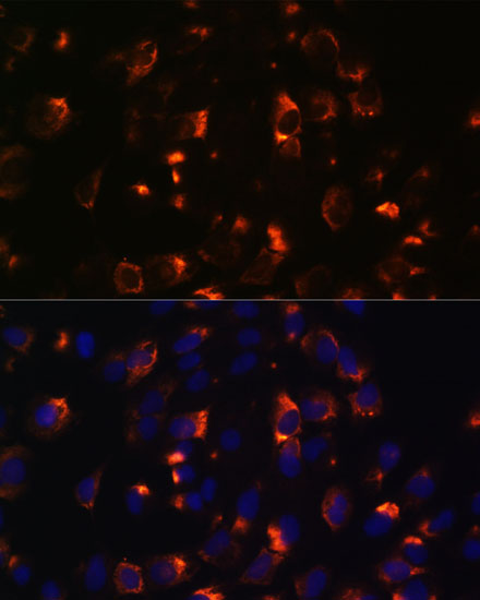 Anti-CCDC47 Antibody (CAB15871)