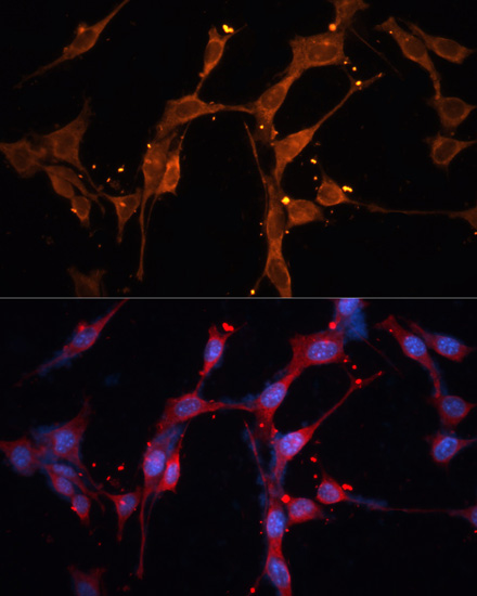 Anti-LPL Antibody (CAB16252)