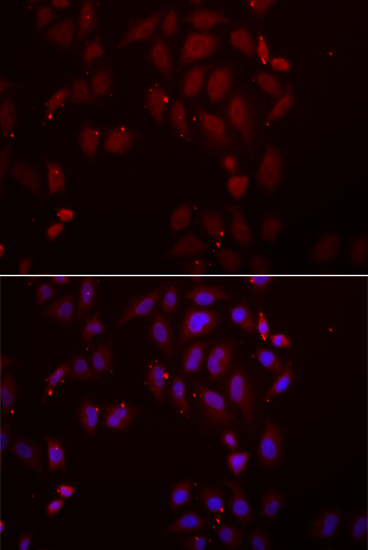 Anti-FRZB Antibody (CAB6592)