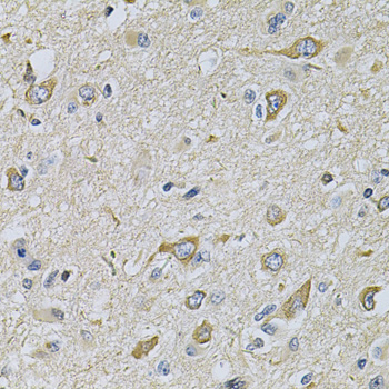 Anti-RAB17 Antibody (CAB7831)