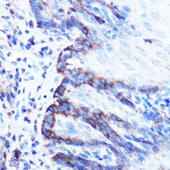 Anti-PDGFA Antibody (CAB17434)