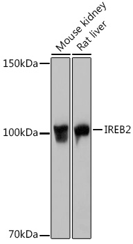 Anti-IREB2 Antibody (CAB6382)