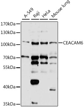 Anti-CEACAM6 Polyclonal Antibody (CAB8440)