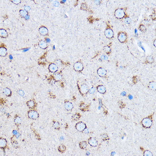 Anti-CTSB Antibody (CAB0967)