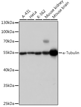 Anti-Alpha-Tubulin Antibody (CABC007)