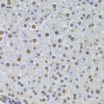 Anti-PPP1R8 Antibody (CAB6701)