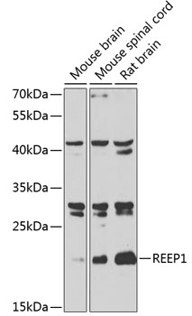 Anti-REEP1 Antibody (CAB7832)