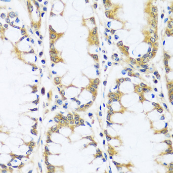 Anti-BLOC1S3 Antibody (CAB17281)