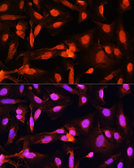 Anti-SGOL1 Antibody (CAB16174)