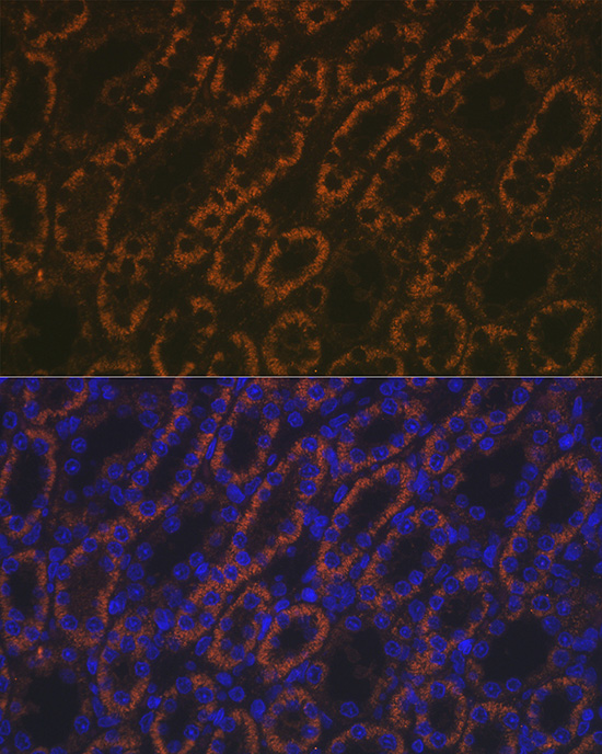 Anti-AMACR Antibody (CAB1130)