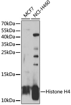 Anti-Histone H4 Antibody (CAB7157)