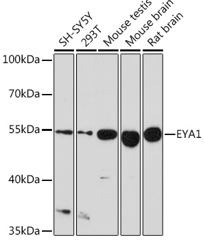 Anti-EYA1 Polyclonal Antibody (CAB9534)