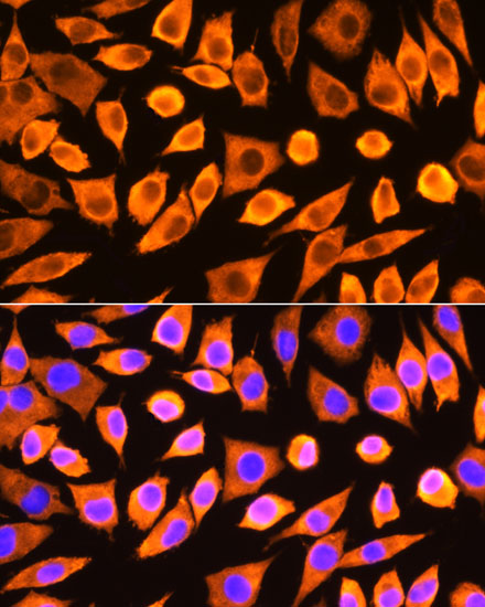 Anti-RPS3 Antibody (CAB13543)