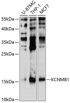 Anti-KCNMB1 Antibody (CAB10224)