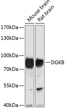 Anti-DGKB Antibody (CAB10534)