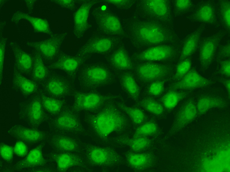 Anti-RAD17 Antibody (CAB5359)