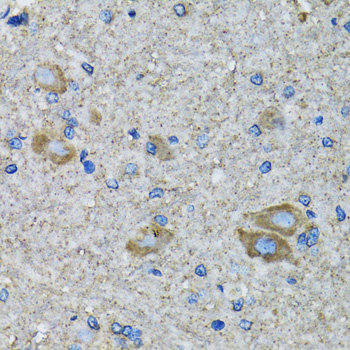 Anti-SSBP1 Antibody (CAB6987)