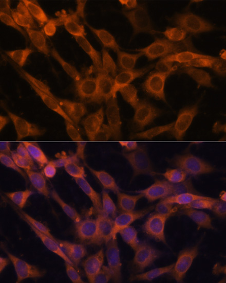 Anti-RAB21 Antibody (CAB12095)